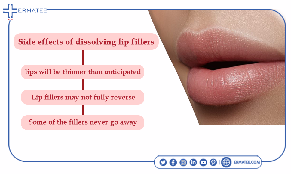 infographic of risks of lip fillers removal